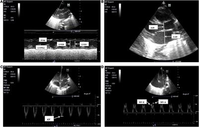 Reference Values for Point-of-Care Echocardiographic Measurements of Preterm Infants in China